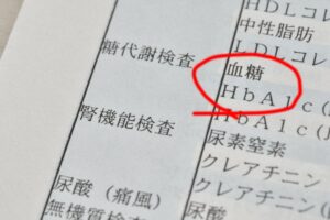 下高井戸の歯医者、カズデンタルクリニックで、コーヒーと歯周病の関係性を解説